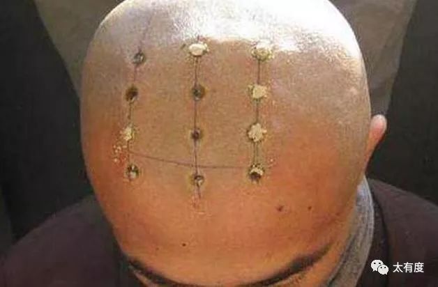 雍正规定僧人头顶烧戒疤，原来是有这样的意思
