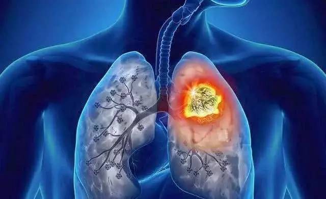 长期吸烟导致肺部严重受伤吗？平时多吃6种食物，排出烟毒，肺更舒服！