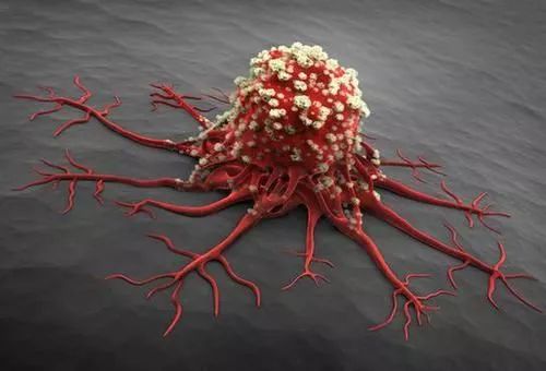 饿死癌细胞并非是谣言，关键在于怎么饿，这是一种很好的抗癌思路