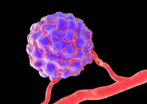 饿死癌细胞并非是谣言，关键在于怎么饿，这是一种很好的抗癌思路