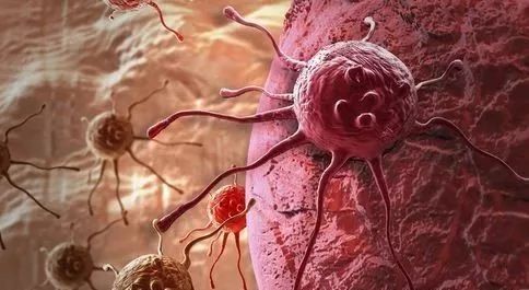 癌细胞的“杀手”是这6种食物，每天吃一种，让癌症离你远远的