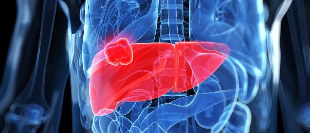 注意：忽视了这6件事，你的肝炎会“升级”成为肝癌