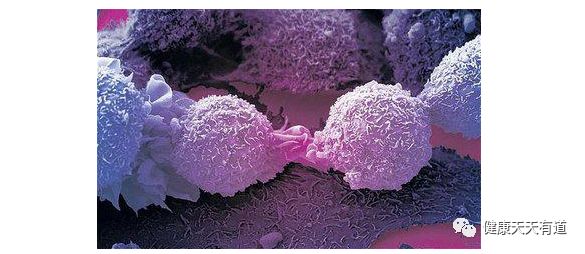 美国研究确定癌症的克星，酸性环境可使癌细胞越来越弱