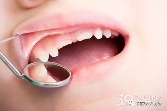 牙齿出现异常 警惕全身疾病