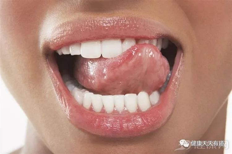 经常咬舌头，可能与3种病有关，你可能一个也不清楚