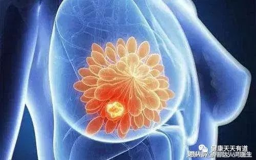 胸大的妹子容易发生乳腺癌吗？