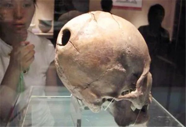 一个5000年前的头颅，因为被开了个“洞”，证明了我国中医的水平