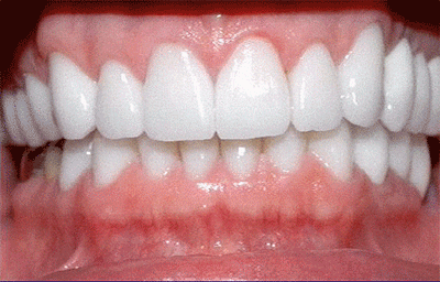 牙膏里加它，牙黄牙垢唰唰落！烂牙变新牙，牙医也在偷着用..