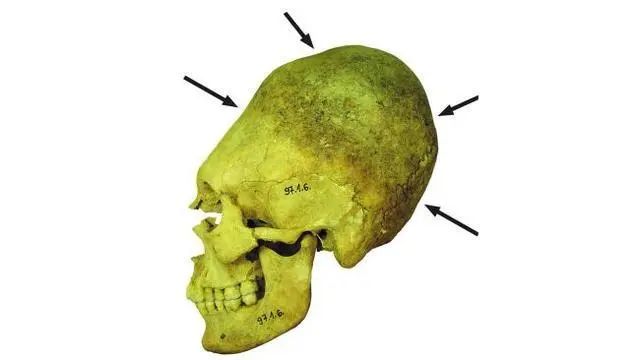 欧洲发现“外星人头骨”，最早至公元5世纪，见证罗马帝国兴衰！