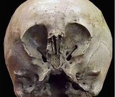 考古挖出900年前怪异头骨，疑似外星人与地球人混血儿