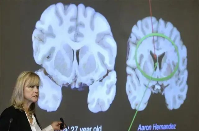 唯一存在，长达2600年“活着的大脑”，科学家：令人难以置信！