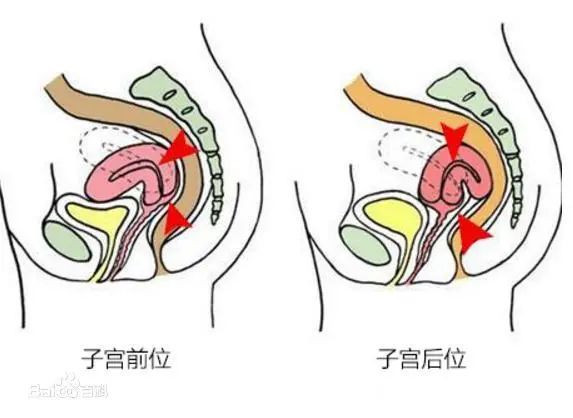 北京医生透露 : 关于子宫前位和后位如何提高受孕率！