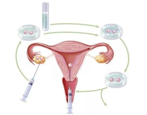 对自己负责，排卵期女备孕用品，助备孕促排卵，不可掉以轻心