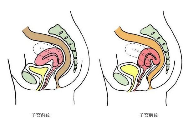 北京医生透露 : 子宫前位好还是后位好，受孕几率哪个高