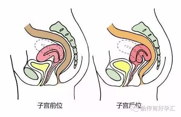 清晰图解子宫前中后位及最易受孕姿势