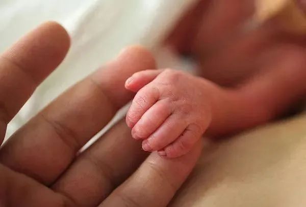 哥伦比亚出现“寄生胎”女婴出生24小时后“生”出双胞胎姊妹