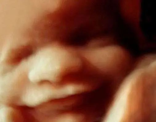 24周孕妈做四维彩超，胎宝全程“微笑”惹人爱，医生：这娃不能留
