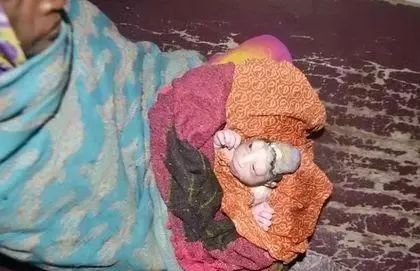 印度婴儿患怪病头长巨瘤外貌吓人，母亲拒喂母乳