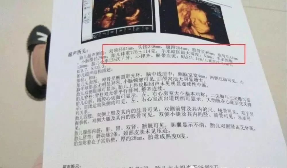 准妈妈最想知道的胎儿秘密，四维彩超这3个数据早有提示，你看懂了没？