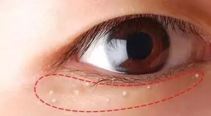 眼睛出现这8种症状，健康要注意！