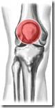 膝盖损伤的治疗方法、预防和护理
