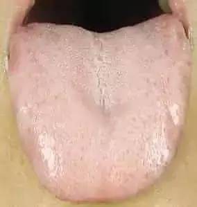 看看你的舌头，看看哪里不舒服！