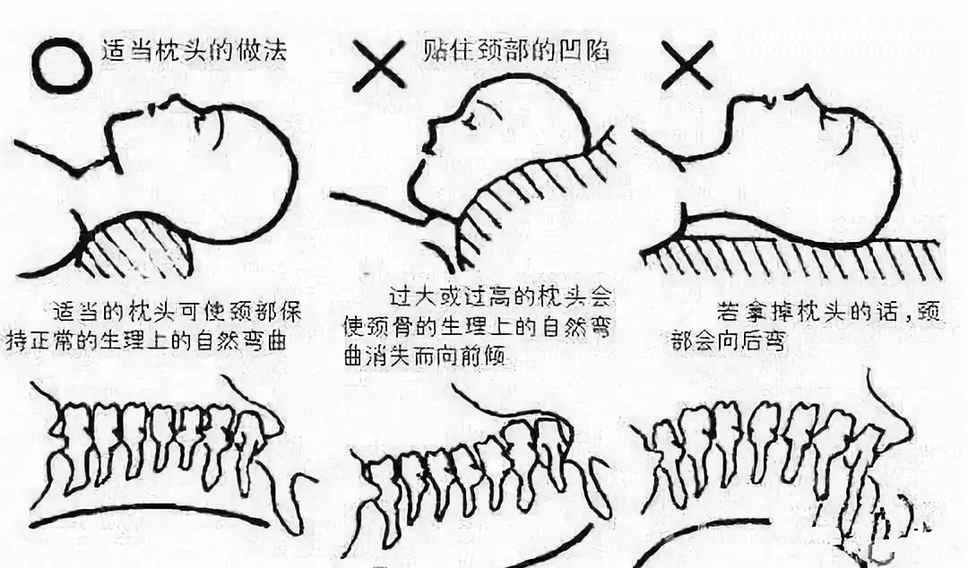 8个方法消除富贵包