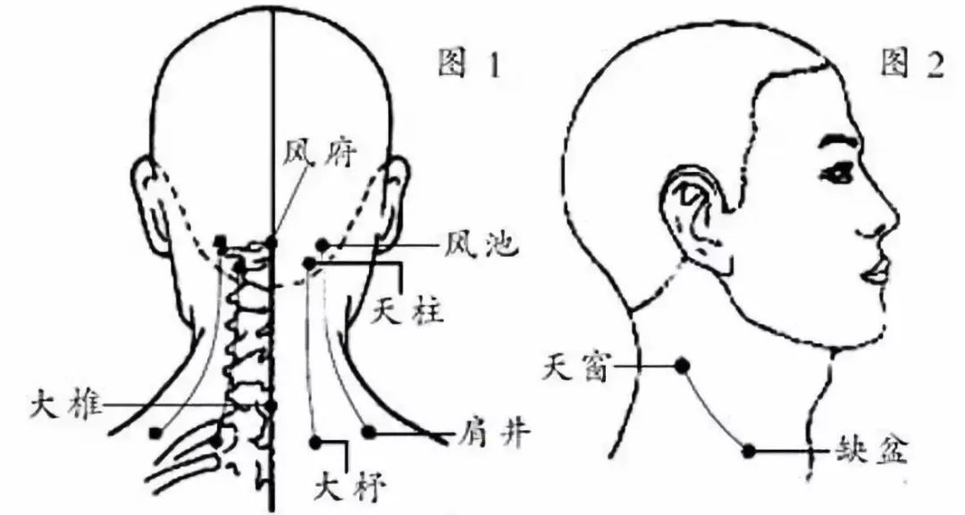 富贵包的十五大危害