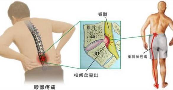 这些伤腰姿势，以后别做了