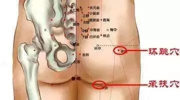 女人臀部是人体的“毒窝”