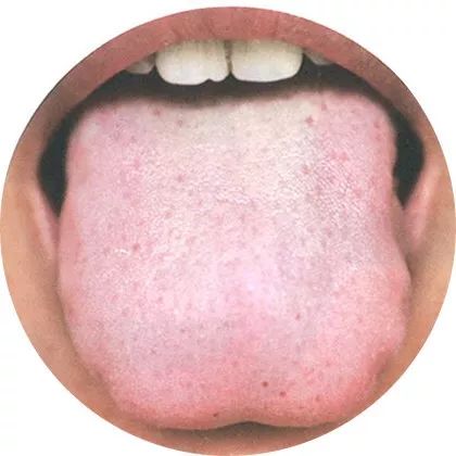 高清舌诊图谱，看舌头知健康
