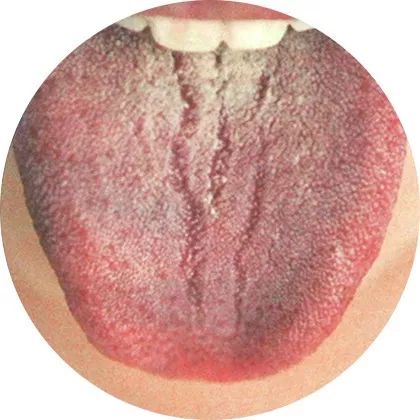 高清舌诊图谱，看舌头知健康