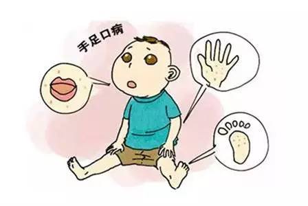 幼儿园提示：手足口病进入流行期，这些预防必须做！