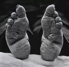 古代的小脚为什么被称为“金莲”?