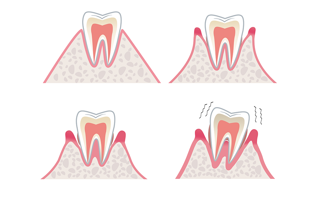 这些牙齿细节是身体健康出现问题的表现！