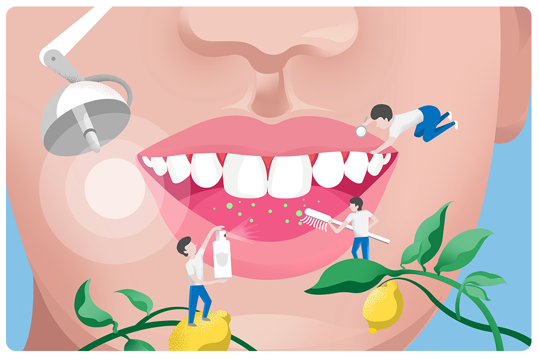 唾液分泌少也会导致蛀牙？