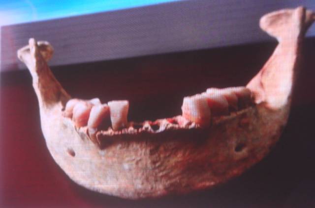 考古学家从曹操墓发现了3颗牙齿，揭开曹操一隐疾！