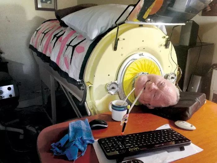 被困“铁桶”69年的铁肺人，一生无法呼吸，停电就意味着死亡！