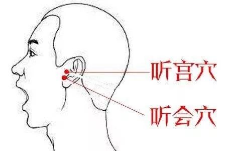 听宫穴：耳鸣、耳聋、聤耳、齿痛