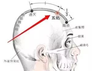 五处穴：头痛、目眩、癫痫