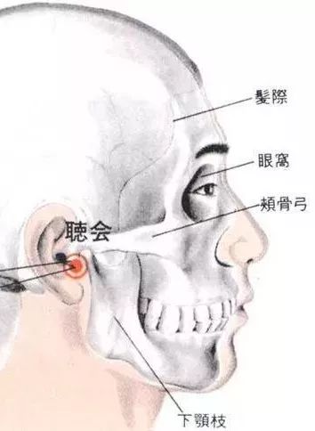 听会穴：下颌脱臼、口眼喎斜、耳鸣耳聋