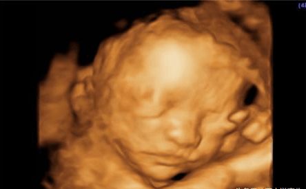 男宝女宝早知道: 9种方法教你判断胎儿性别, 接健康宝宝!