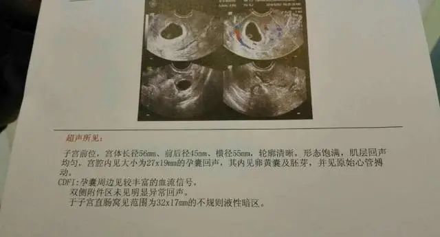 怀孕9个月，产检后孩子却“胎死腹中”，医生：孕妇为何不听话