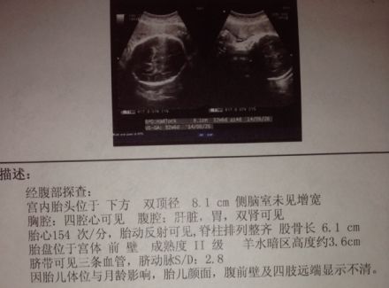 通过孕检单数据，提前预测腹中宝宝“公主、王子”，怀孕总结