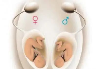 五种辨别孕妇腹中胎儿性别的小方法 准确率奇高