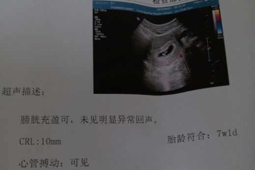 通过孕检单数据，提前预测腹中宝宝“公主、王子”，怀孕总结