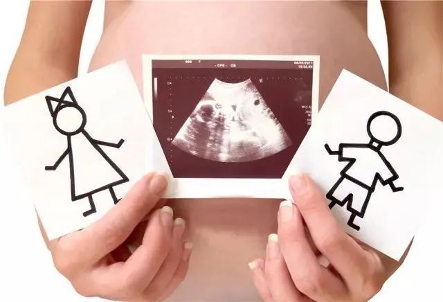产科医生明明知道胎儿性别却不说，会不会憋得慌？医生：你猜
