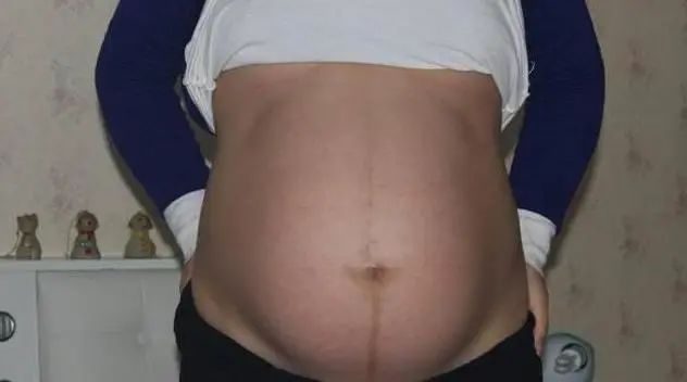 假如你孕期有这些症状, 肯定就是怀了女孩!