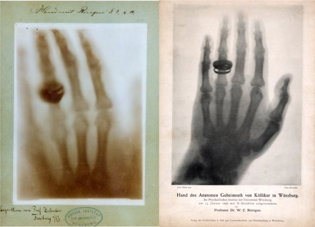 第一个诺贝尔物理学奖获得者伦琴发现X射线的故事