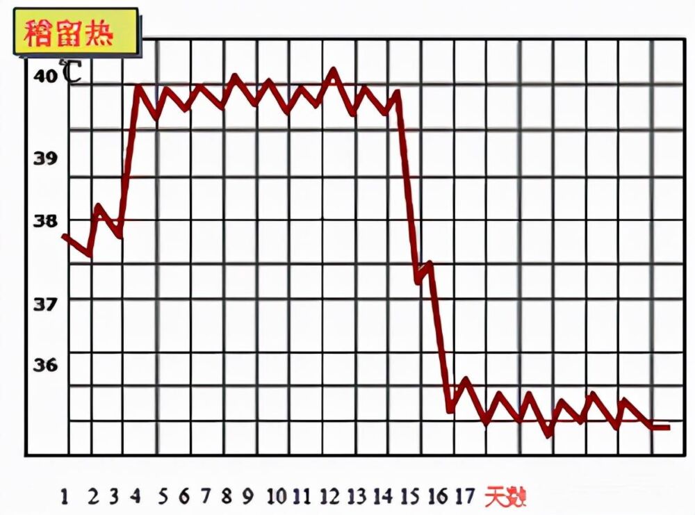 内科常见症状之发热，主治医师考点总结附考题和答案